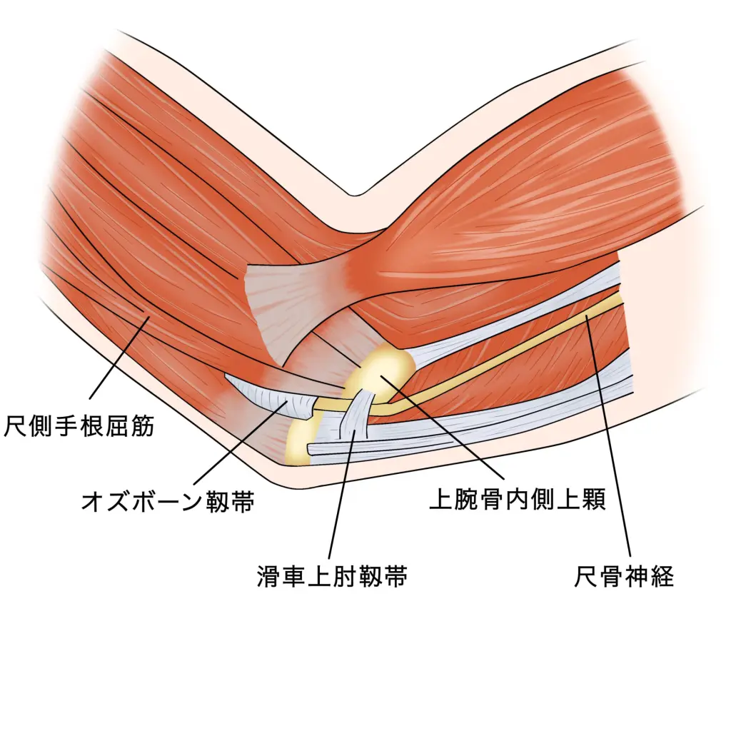 腕の小指側だけが痛い、痺れる」「小指と薬指だけが痺れる